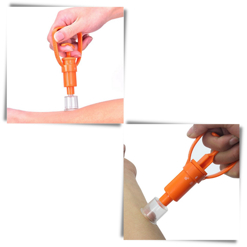 Kit d'extraction d'urgence de venin