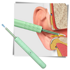 Cure Oreille Intelligent