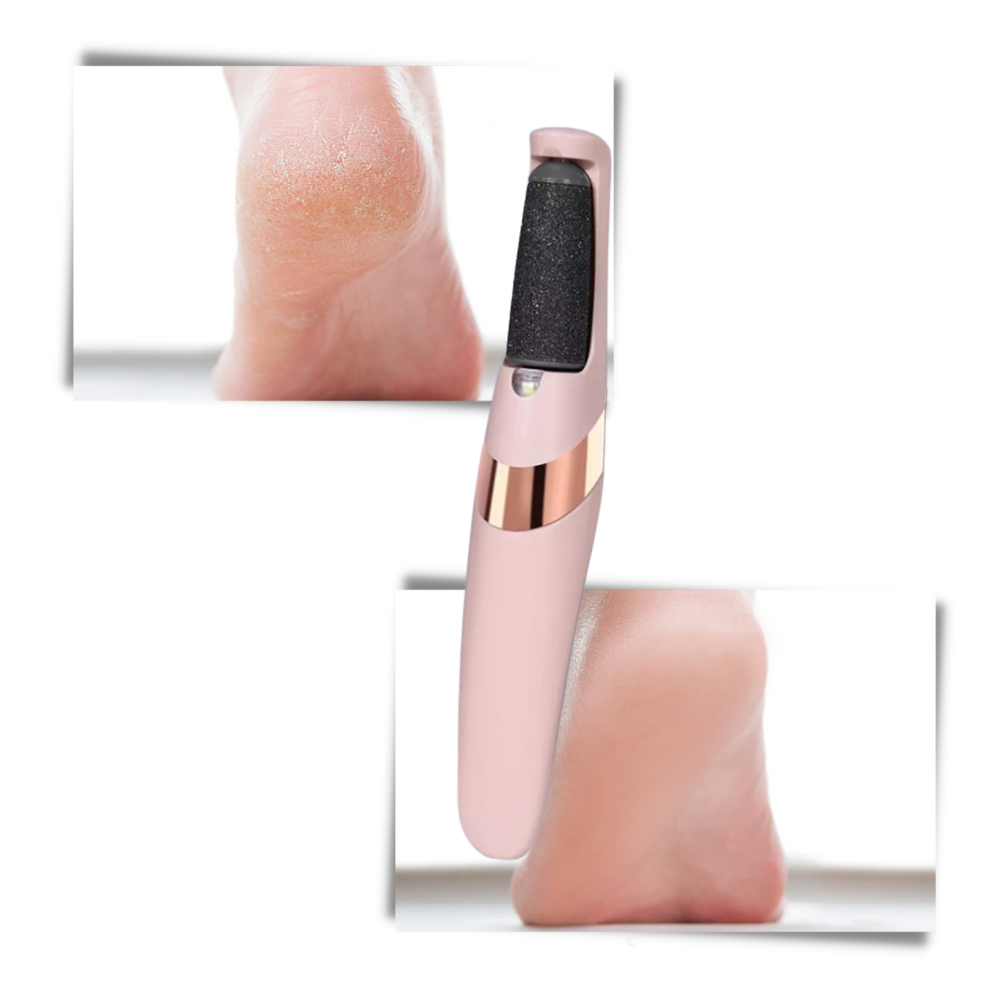 Éliminateur électrique de callosités