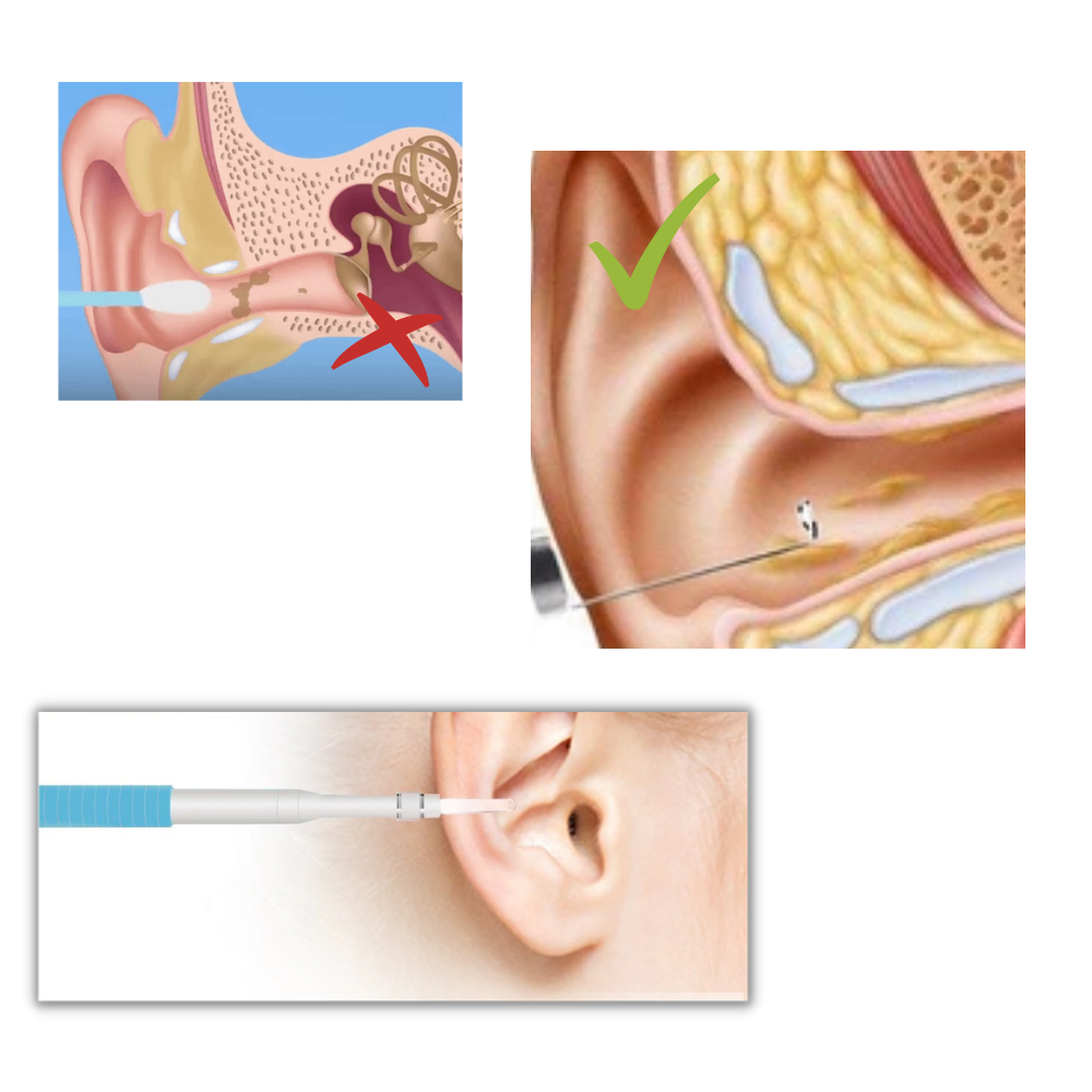 Caméra auriculaire 3 en 1