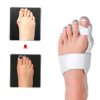 Correcteur orthopédique d'oignon