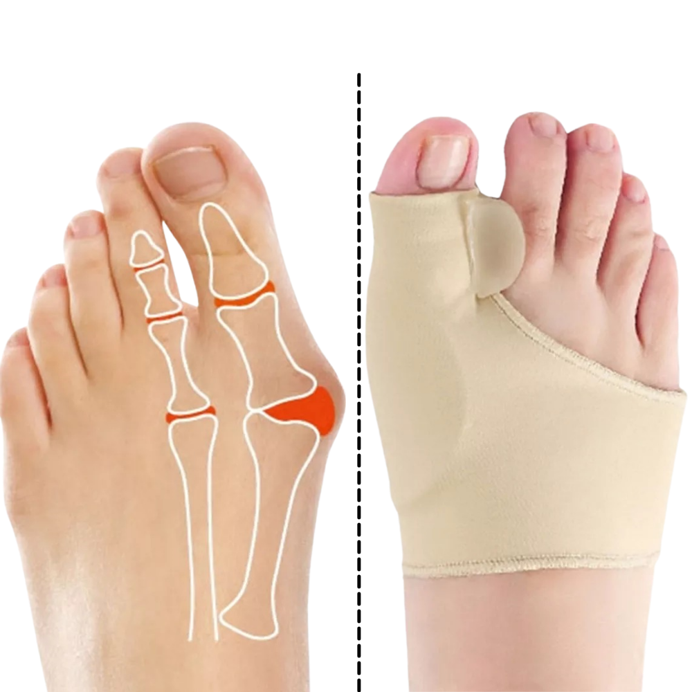 Correcteur d'oignons de pieds en gel