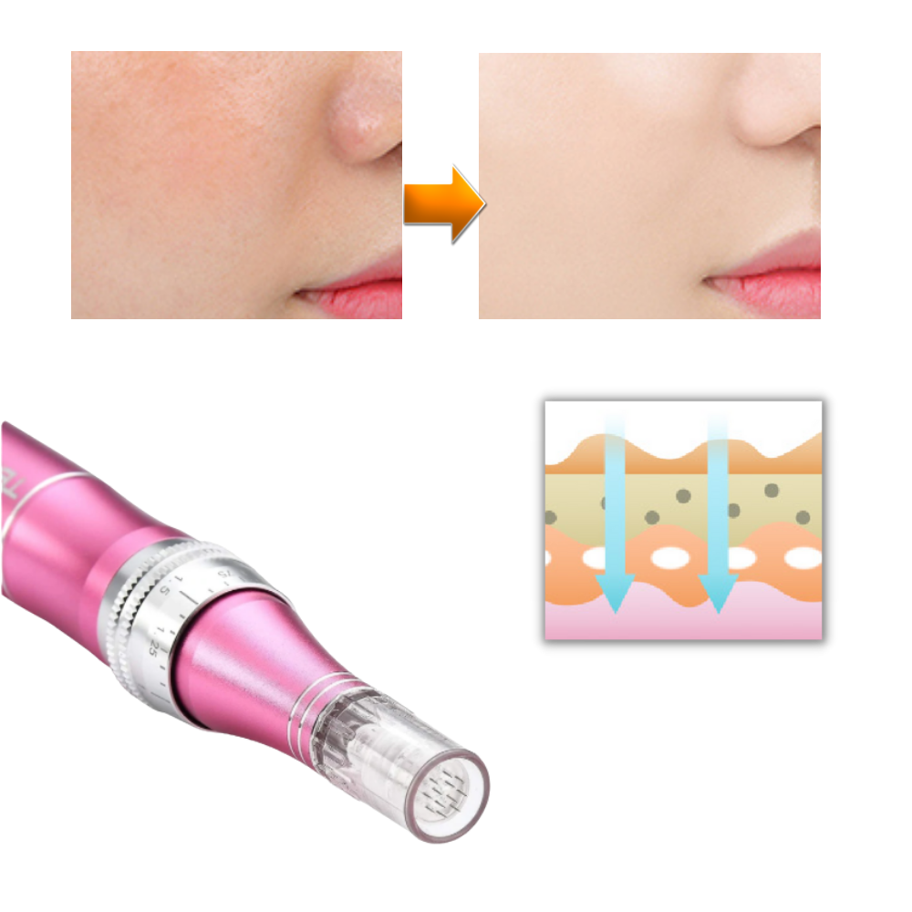 Stylo Dermique de Micro-aiguilletage