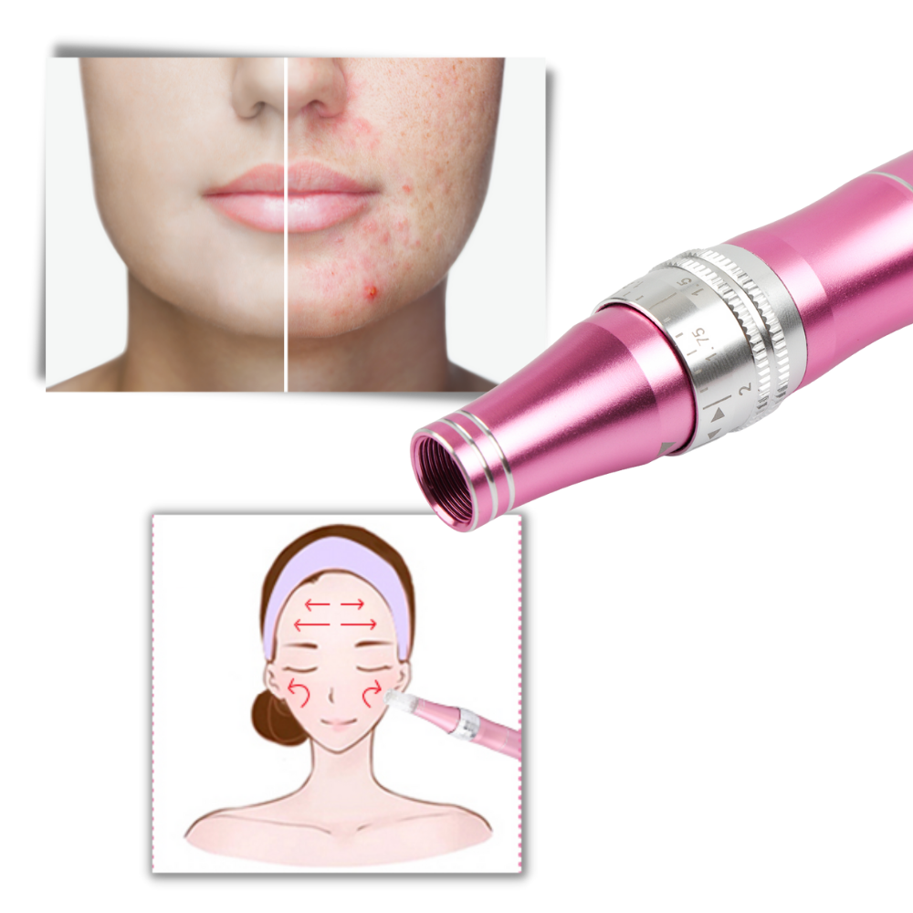 Stylo Dermique de Micro-aiguilletage