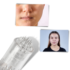 Stylo Dermique de Micro-aiguilletage