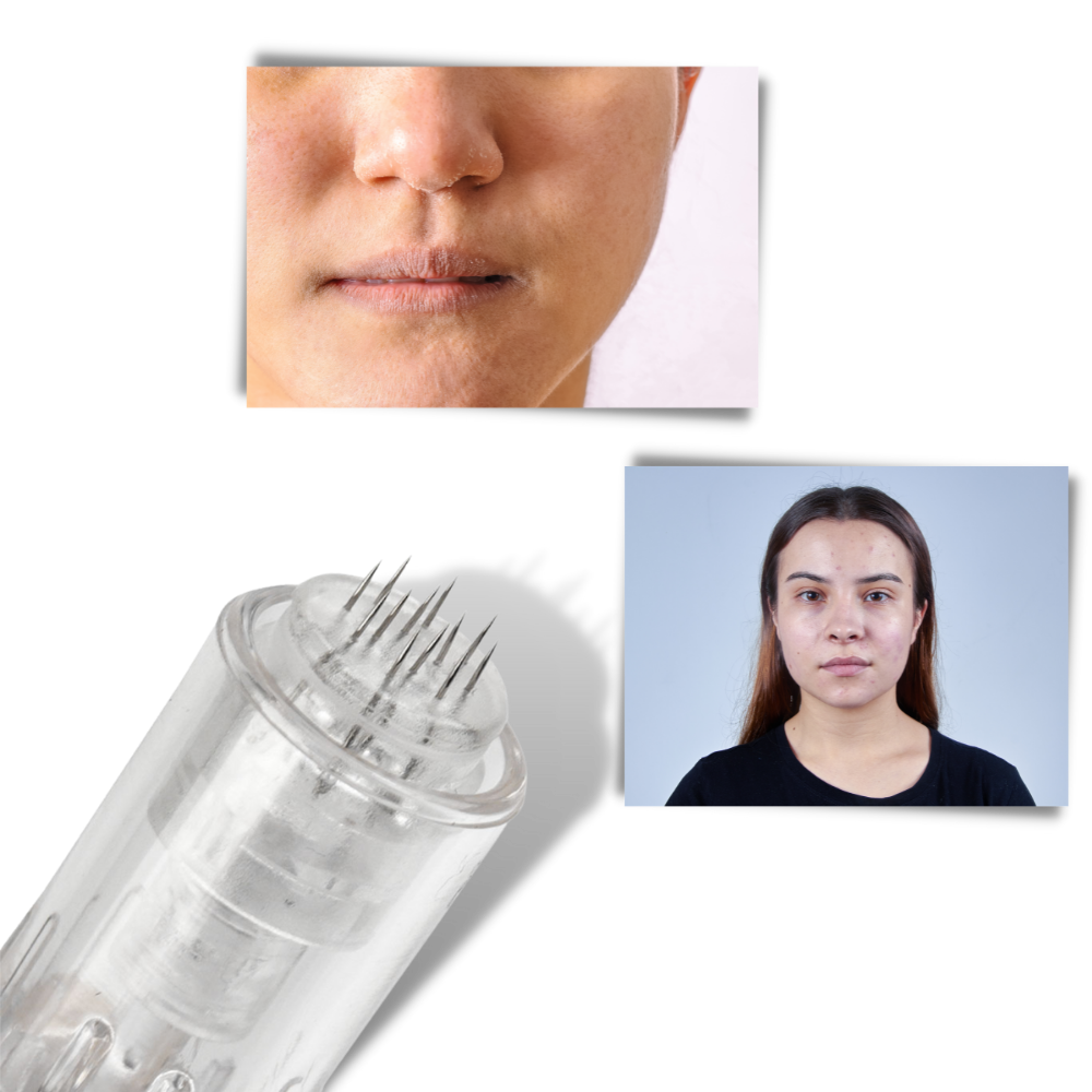 Stylo Dermique de Micro-aiguilletage