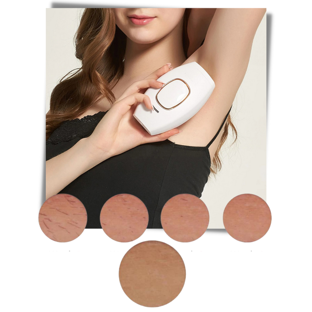 Mini épilateur laser IPL