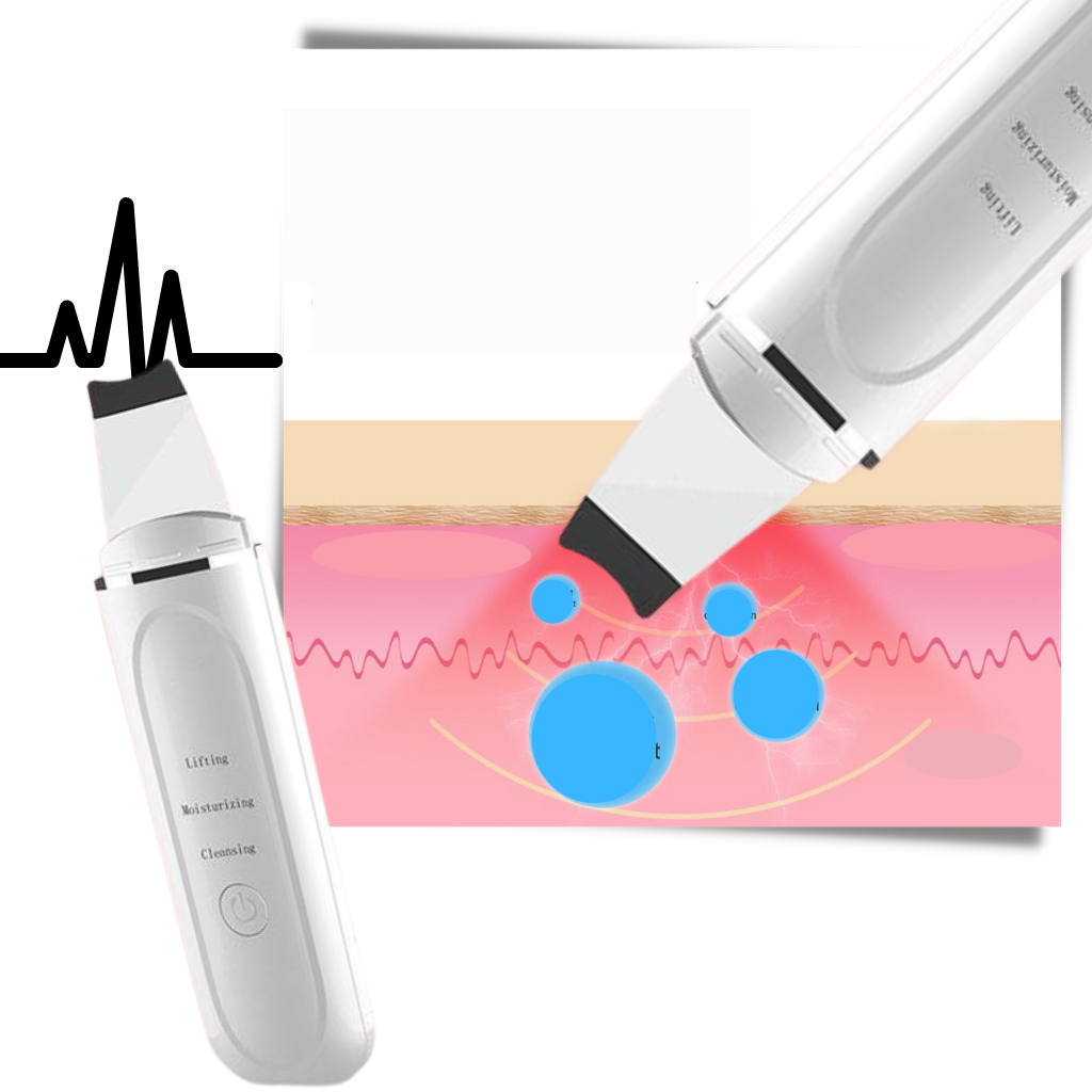 Spatule exfoliante ultrasonique pour le visage