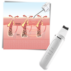 Spatule exfoliante ultrasonique pour le visage