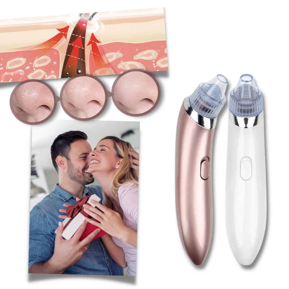 Aspirateur de points noirs du visage