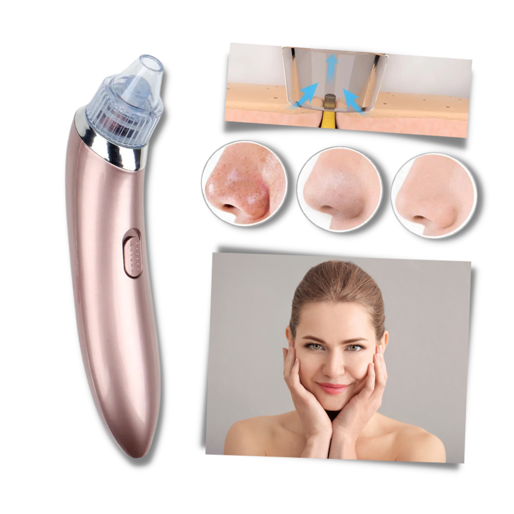 Aspirateur de points noirs du visage