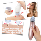 Aspirateur de points noirs du visage