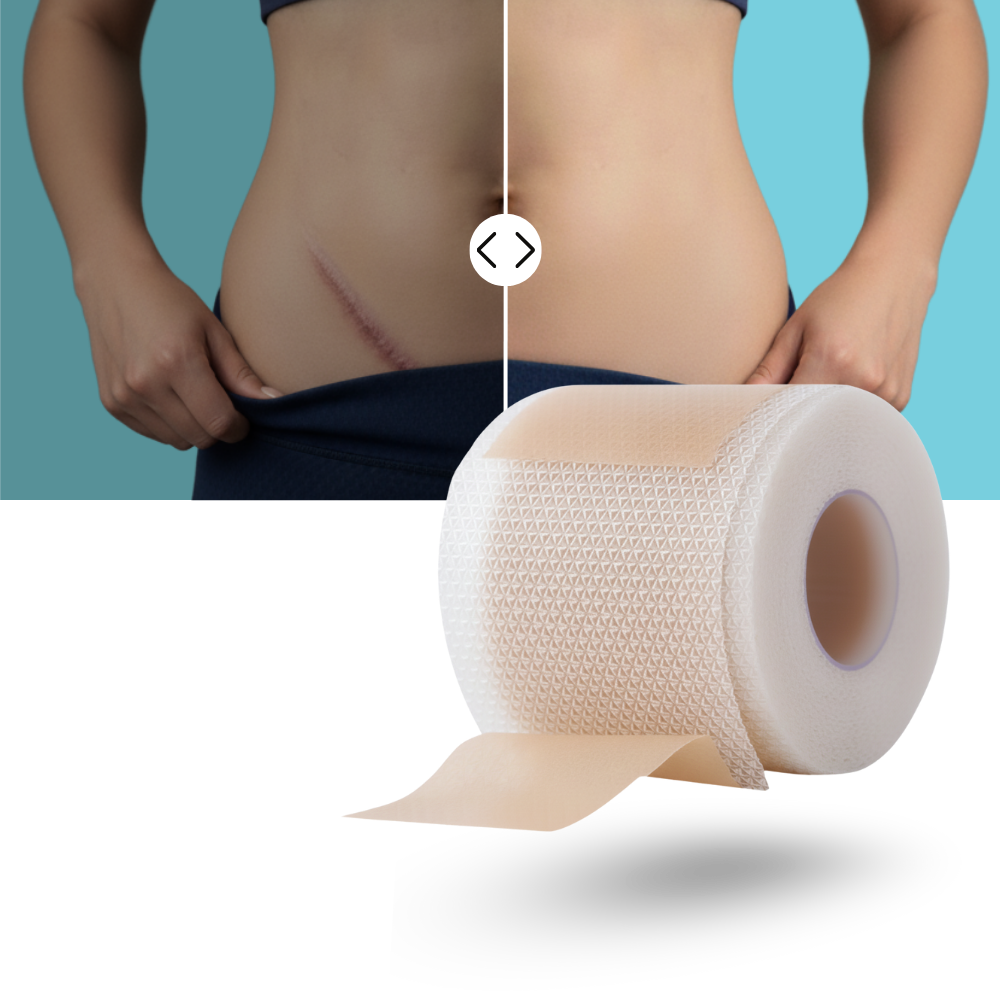 Patch en silicone  à l'acide hyaluronique pour cicatrices