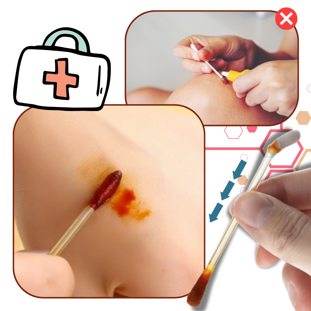 Cotons-tiges à l'iode et à l'alcool