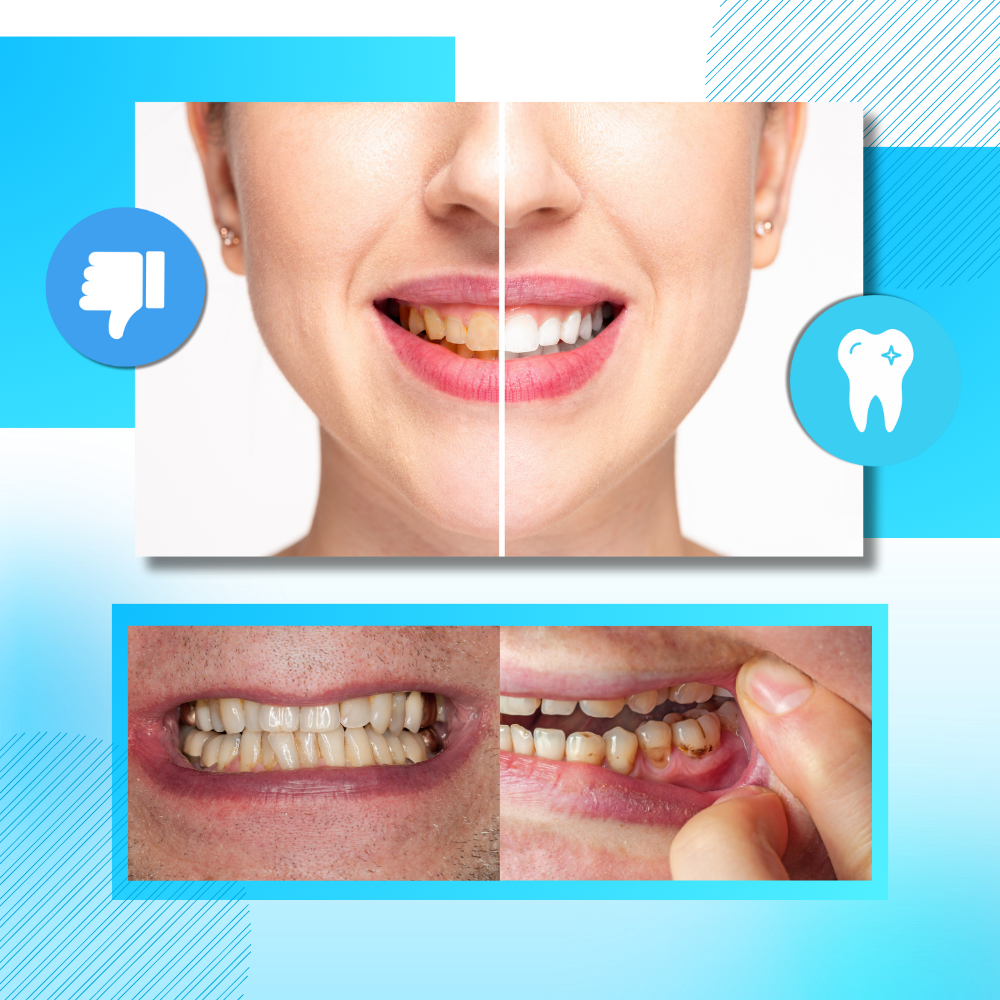 Bandes de blanchiment des dents au charbon et à la menthe