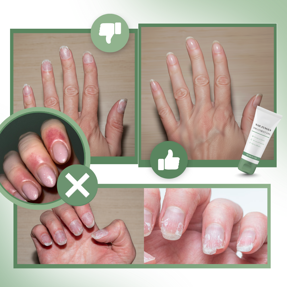 Gel fortifiant et hydratant pour les ongles