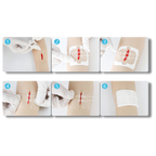 Adhésif étanche pour les plaies