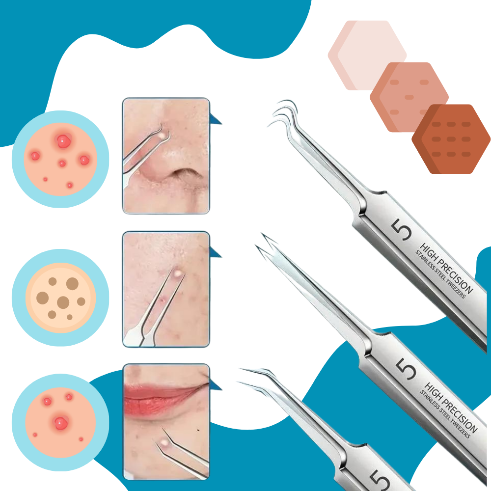 Pinces de précision pour points noirs