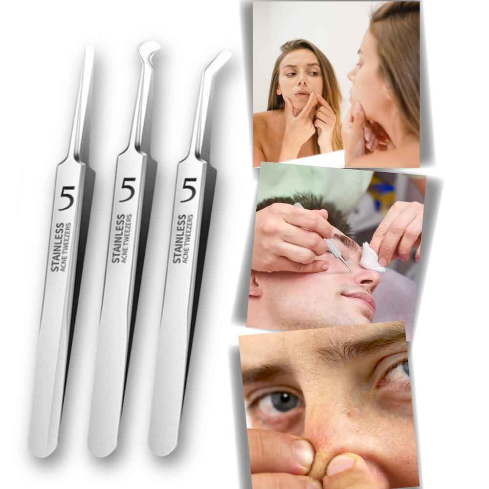 Pinces de précision pour points noirs